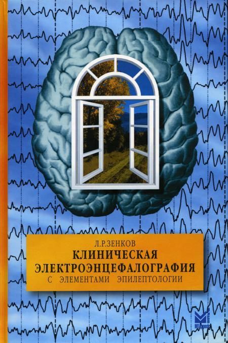 Клиническая электроэнцефалография (с элементами эпилептологии). Руководство для врачей. Зенков Л.Р. Клиническая электроэнцефалография (с элементами эпилептологии). Руководство для врачей. Зенков Л.Р.