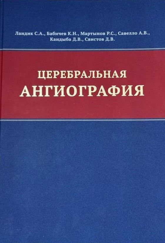 Церебральная ангиография Церебральная ангиография